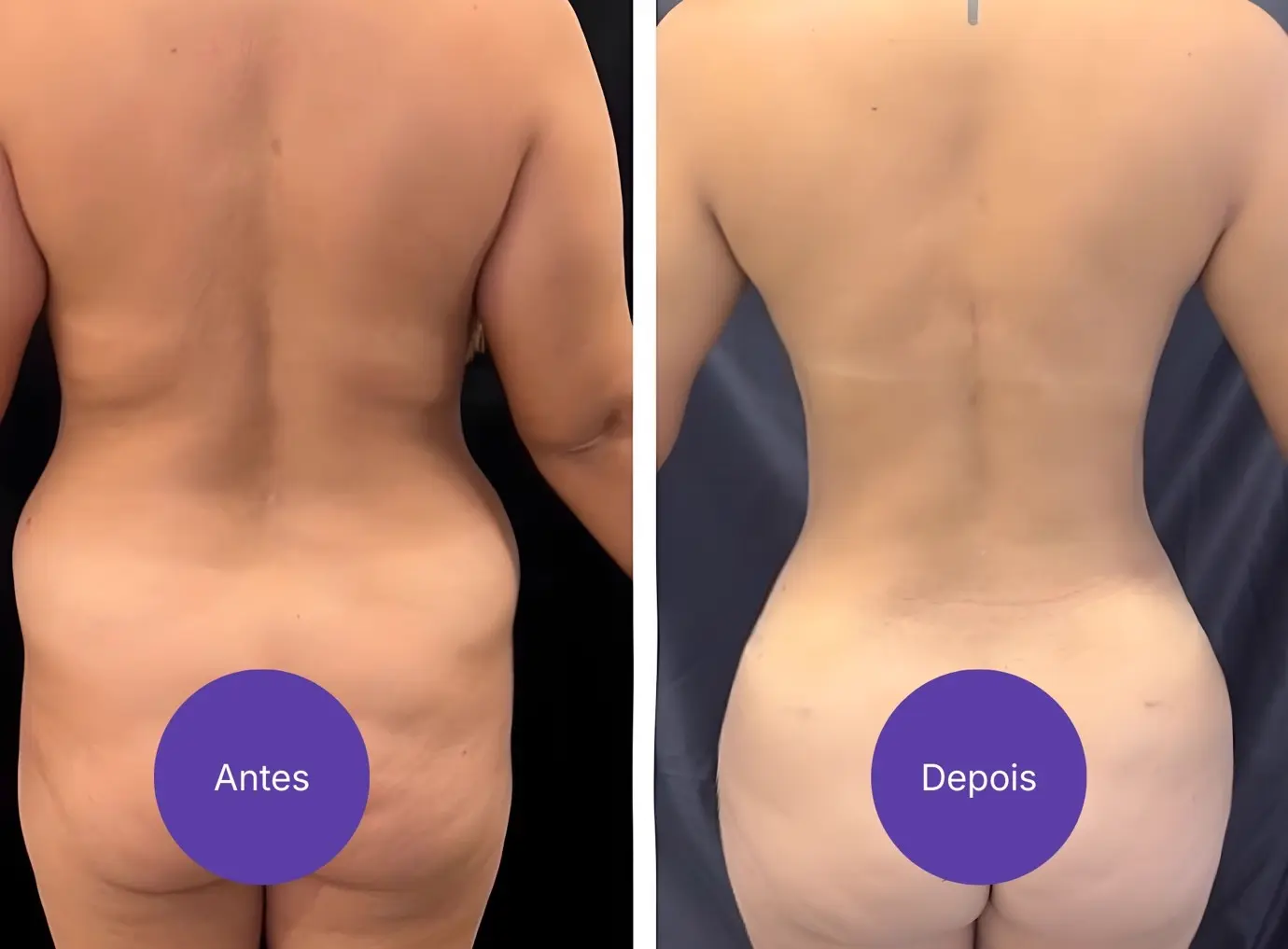 A Equação do Estilo de Vida: Antes e Depois