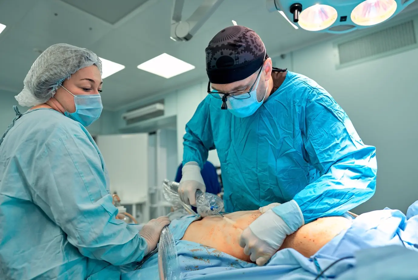 O Que a Lipoaspiração Realmente Faz — e Não Faz